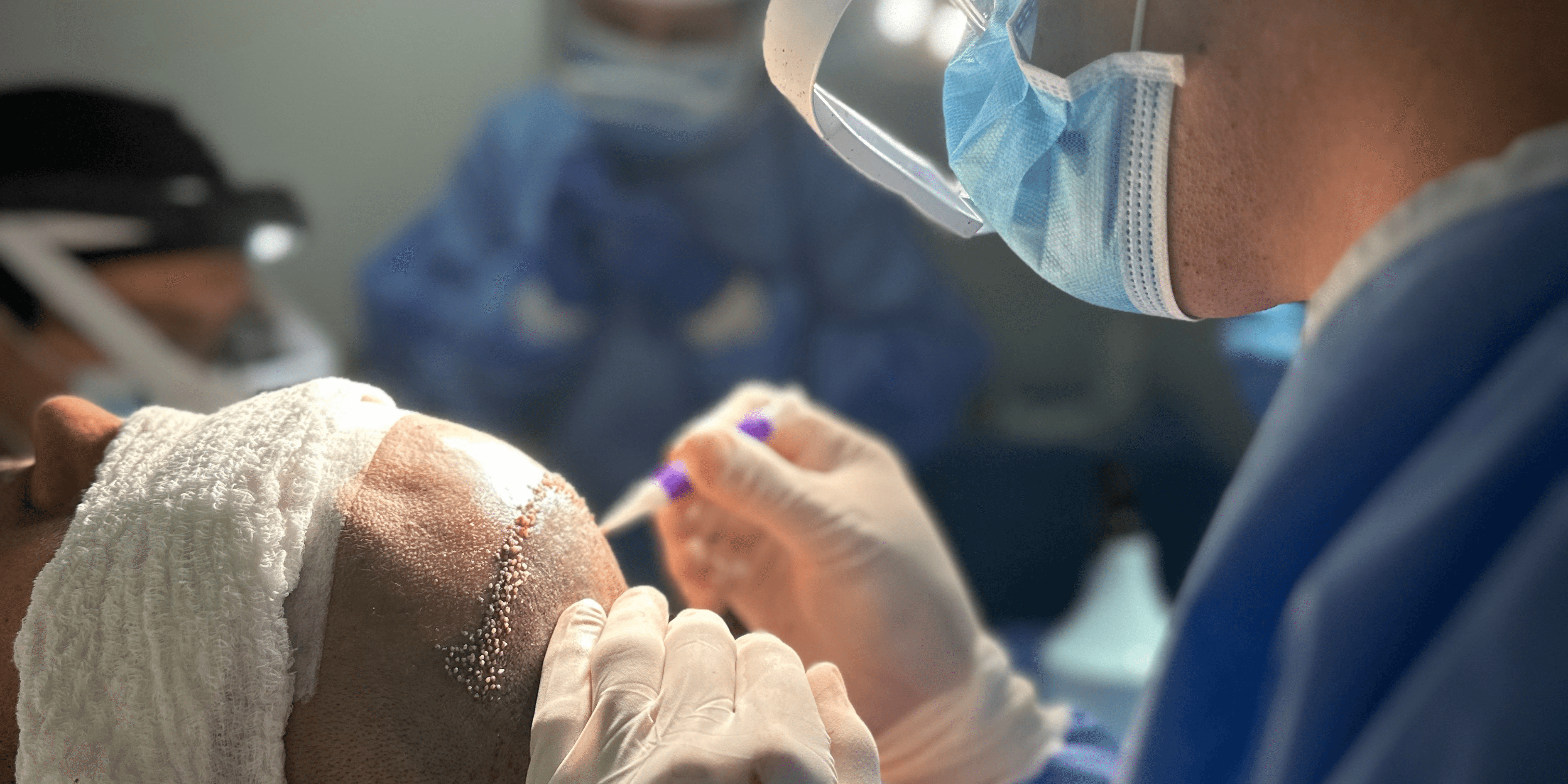 Cuidados Postoperatorios del Implante Capilar