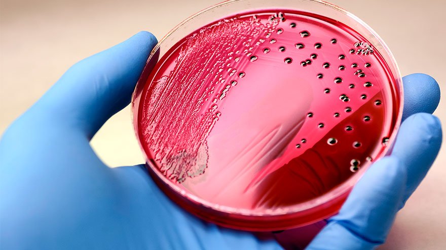 A Petri dish 