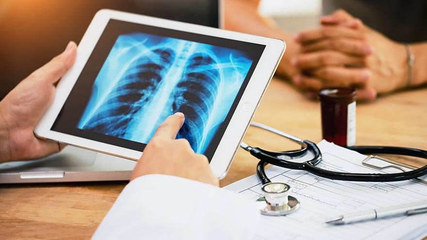 Lung X-ray