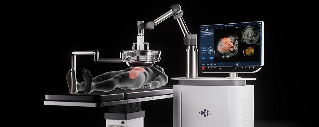 HistoSonic Edison® Liver Ablation system at Renown Health
