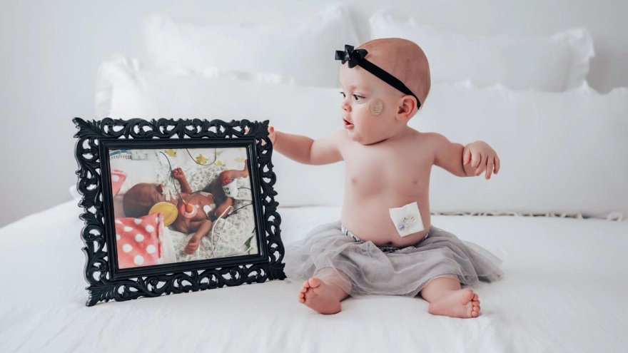 Sloan Johnson a Renown Childrens Hospital patient sits by a photo of herself in the NICU