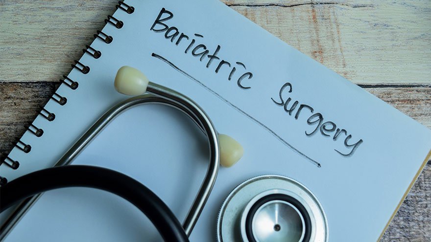 Concept of Bariatric Surgery write on book with stethoscope isolated on Wooden Table.