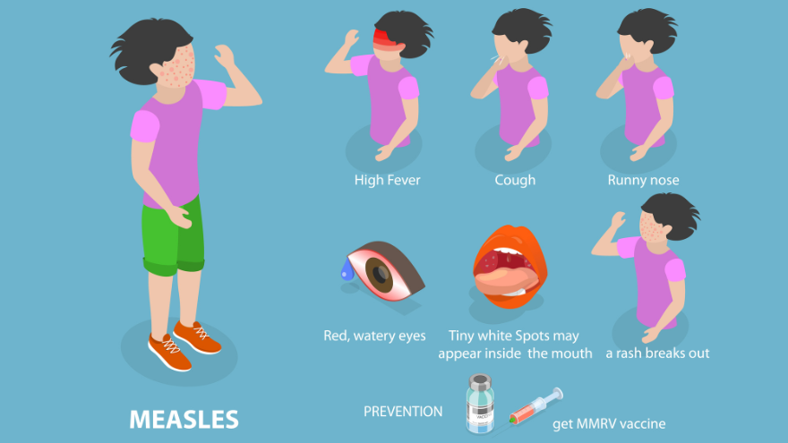 3D Isometric Flat Vector Conceptual Illustration of Measles