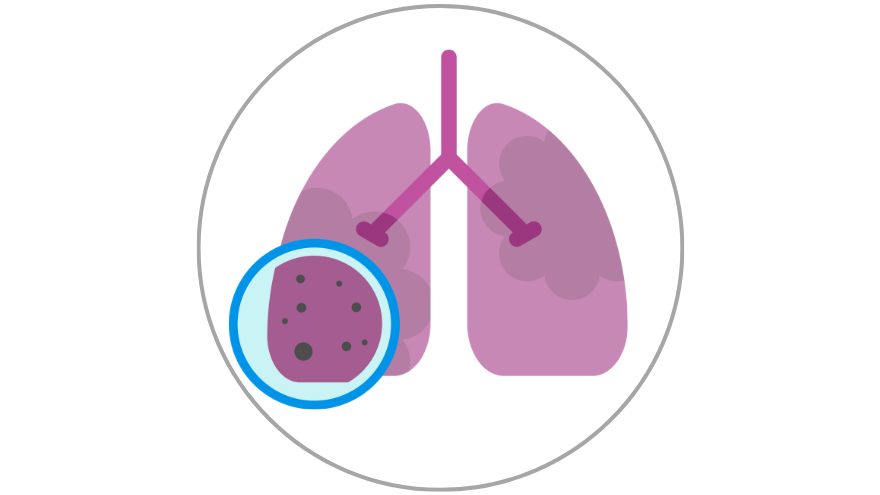 Pulmonary Lung Issues icon