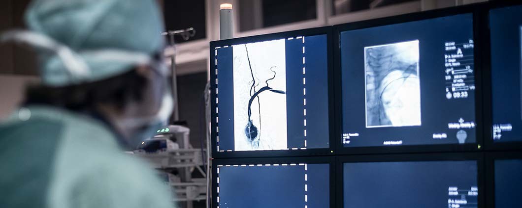 Doctor looking and Neuroradiology imaging