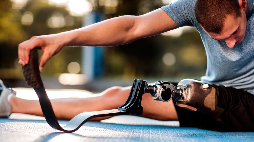 A man with artificial leg