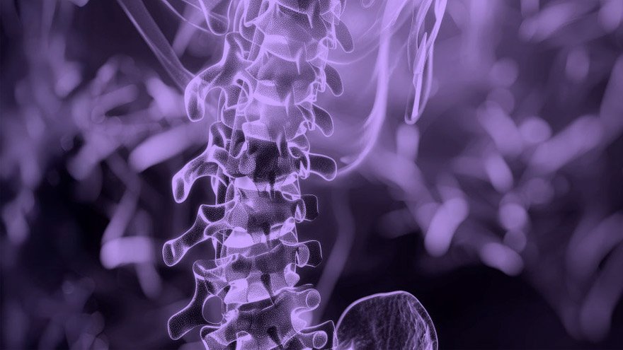 Image of human spine