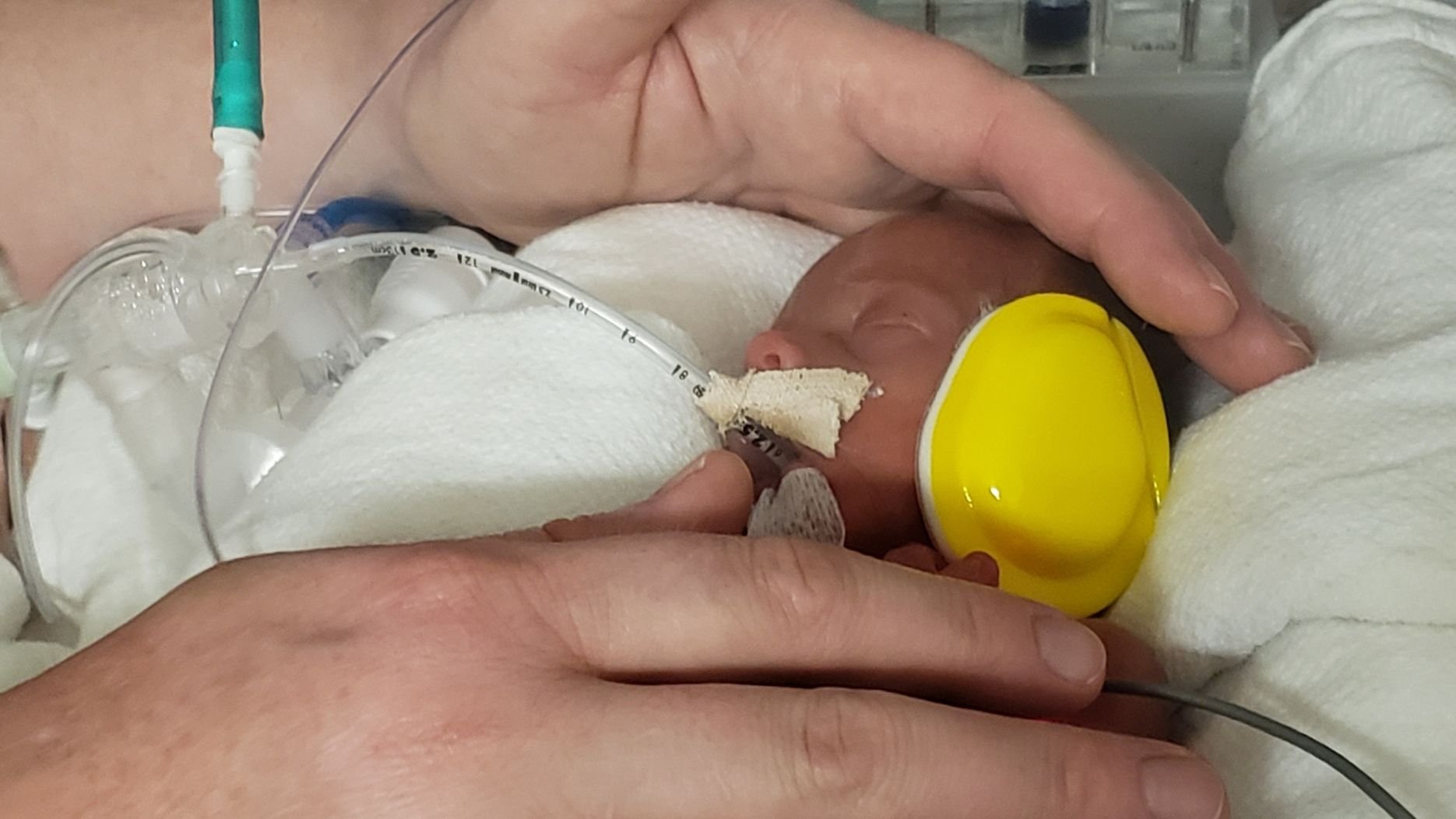 a nicu baby sleeps while a parent places their hands near the baby