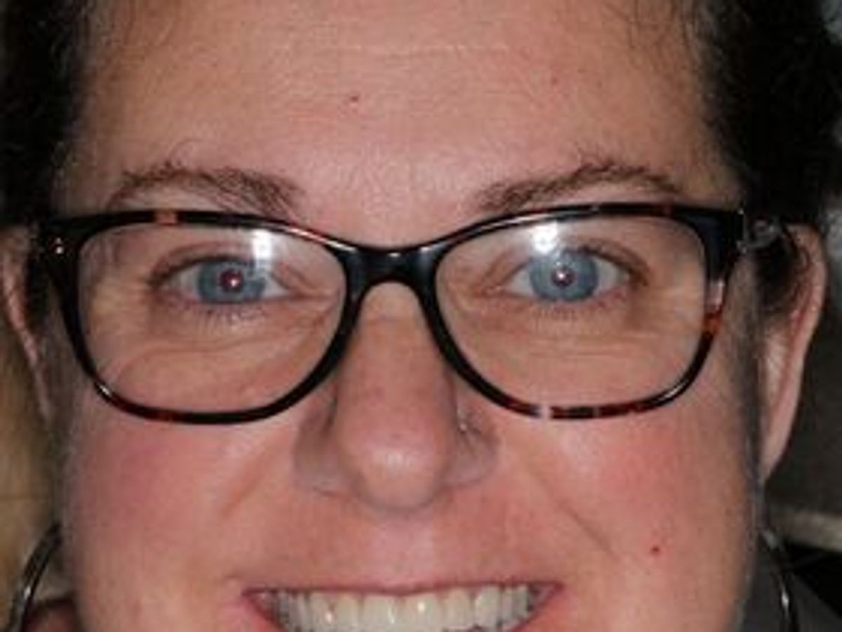 Veneers: Case 30 — after