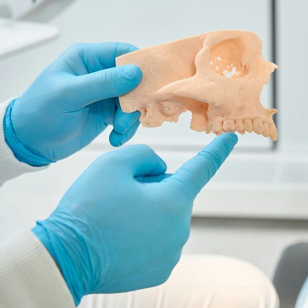 Gloved hand holding a model of the jaw and skull