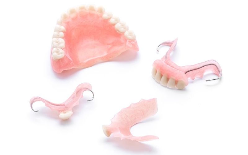 A Look at Full vs. Partial Dentures