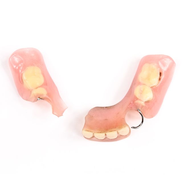 Why Traditional Dentures Can Lead to Bone Loss