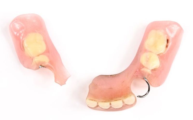 Why Traditional Dentures Can Lead to Bone Loss