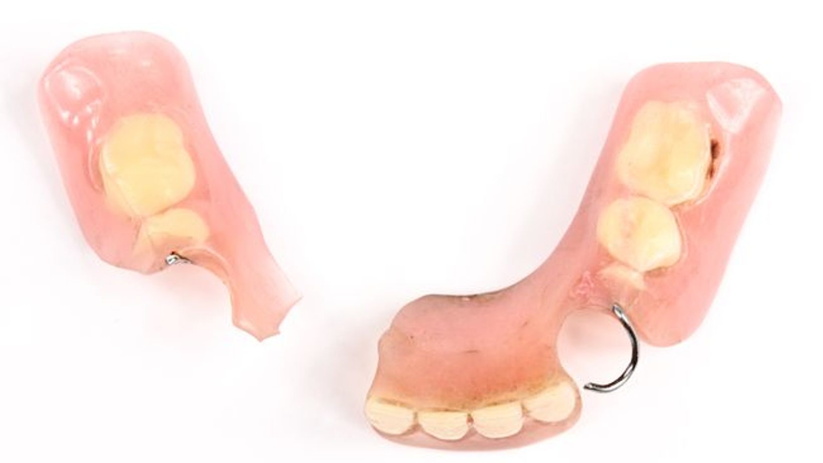 Why Traditional Dentures Can Lead to Bone Loss