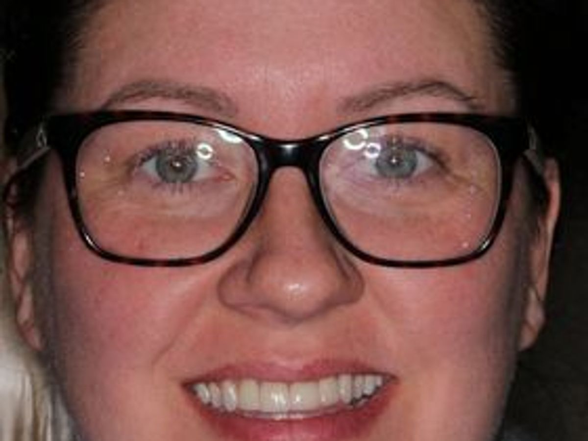 Veneers: Case 20 — after