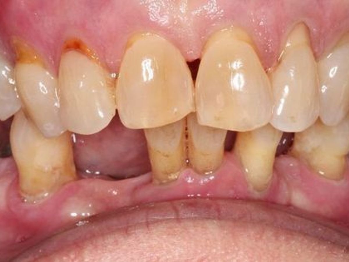 Teeth in a Day: Case 7 — before