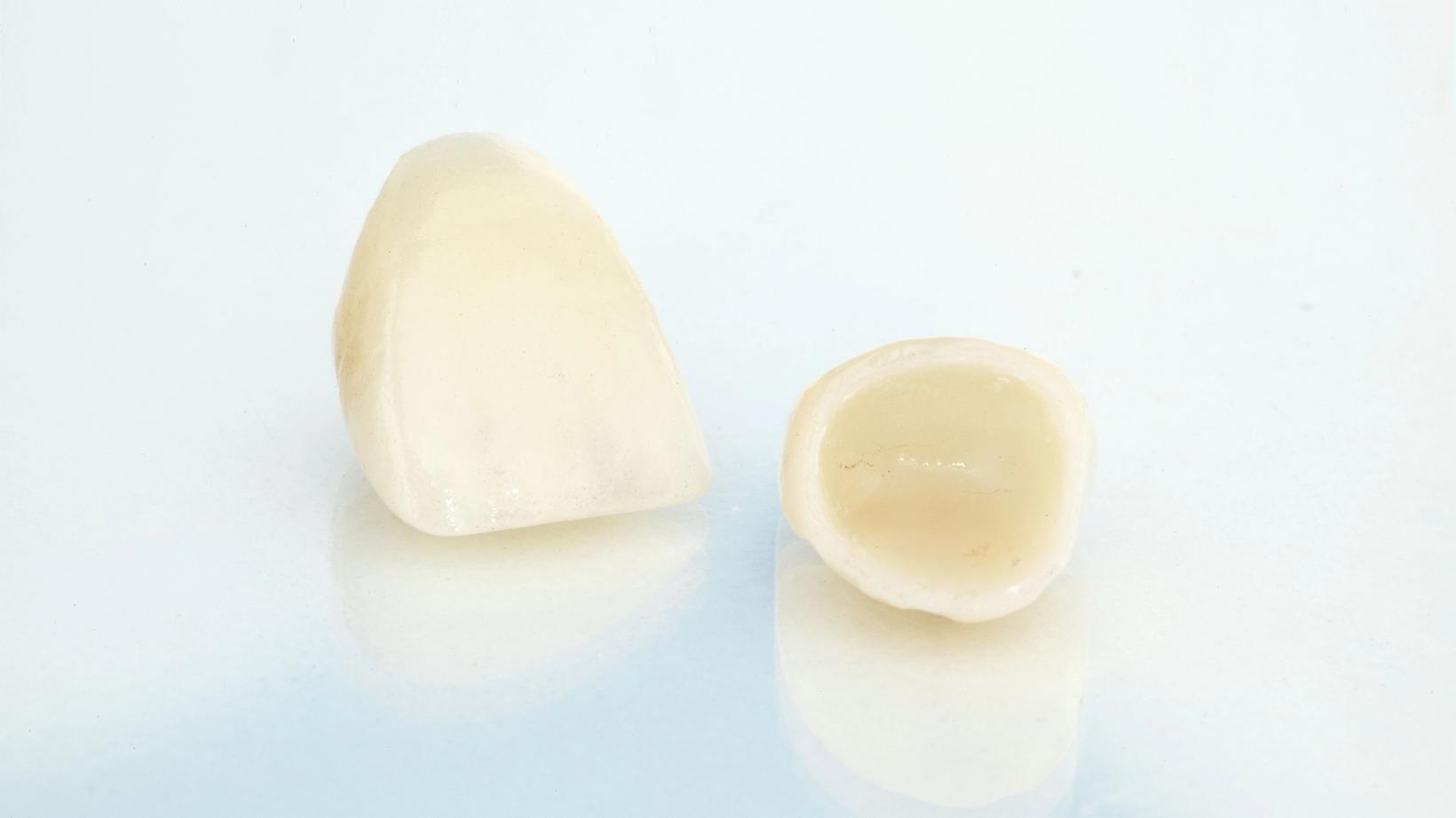 What Causes Damage to Crowns and Fillings?