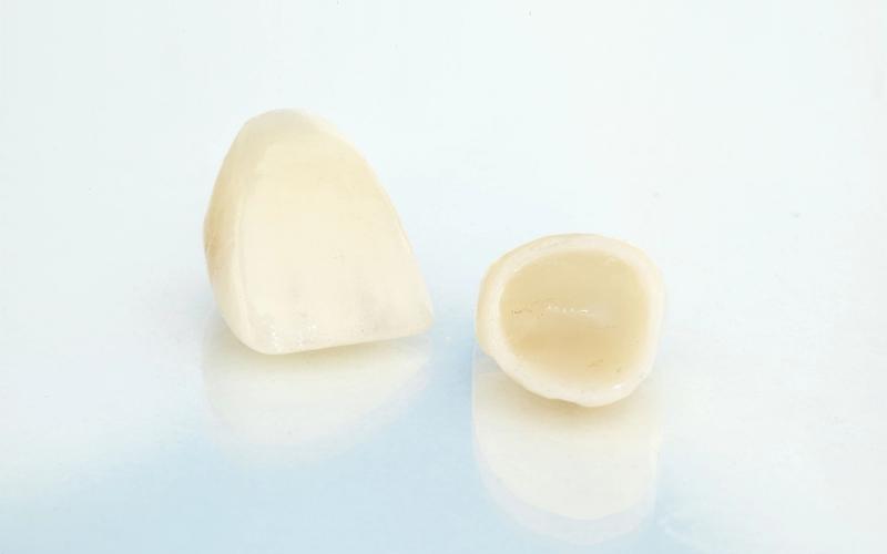 What Causes Damage to Crowns and Fillings?