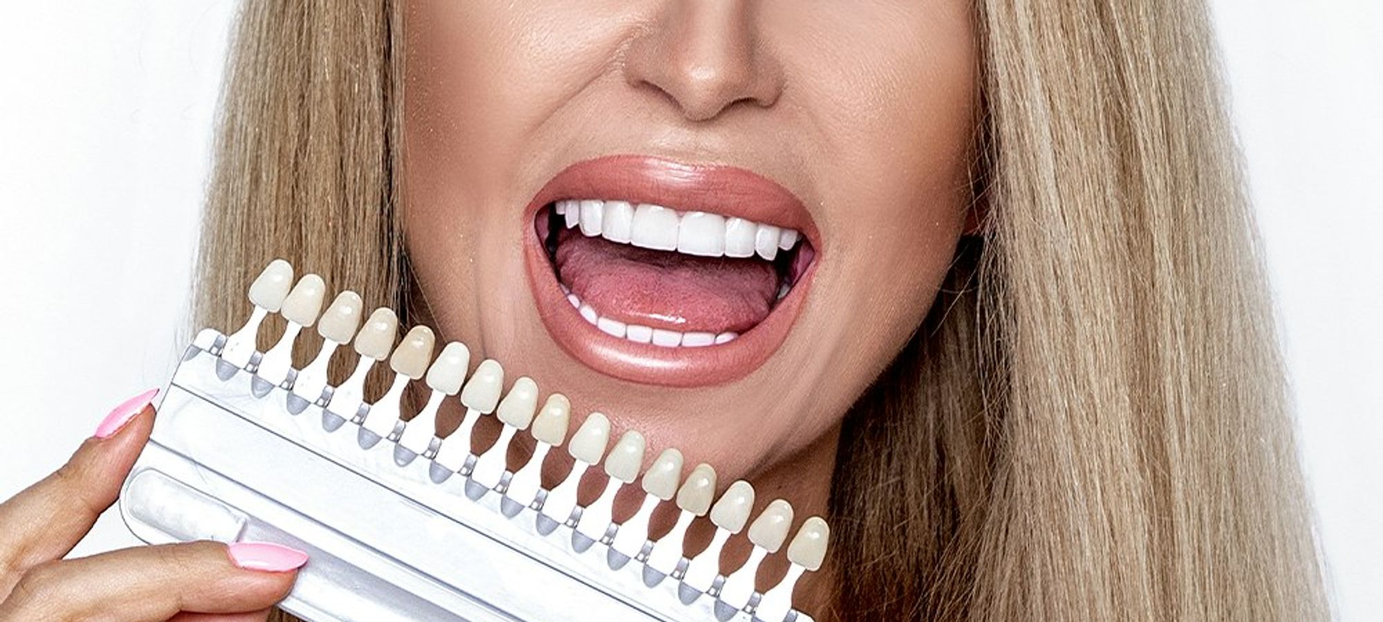 Porcelain veneers