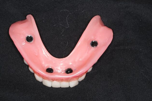 Dentures: Case 19 — after