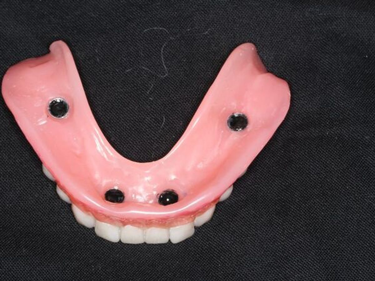 Dentures: Case 19 — after