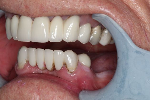 Teeth in a Day: Case 24 — before
