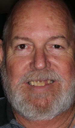 Full Mouth Reconstruction: Case 5 — before