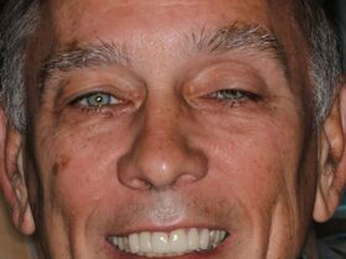 Veneers: Case 31 — after
