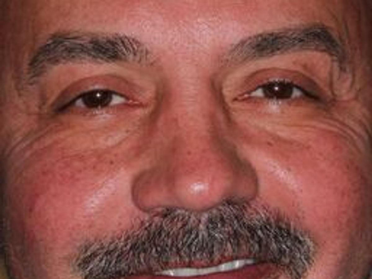 Veneers: Case 28 — after