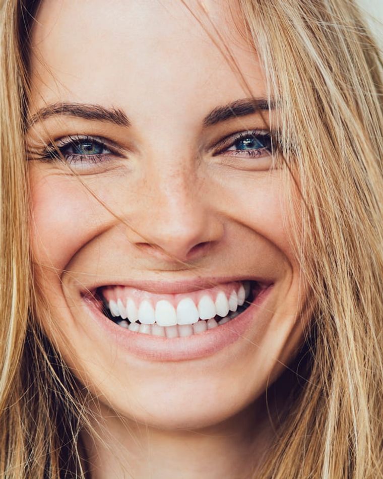 In-office whitening with Opalescence Boost