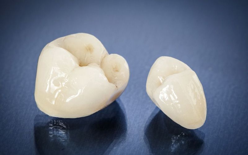 Porcelain Crown vs. Veneers