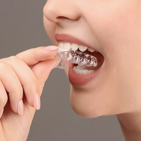 Woman putting on invisalign