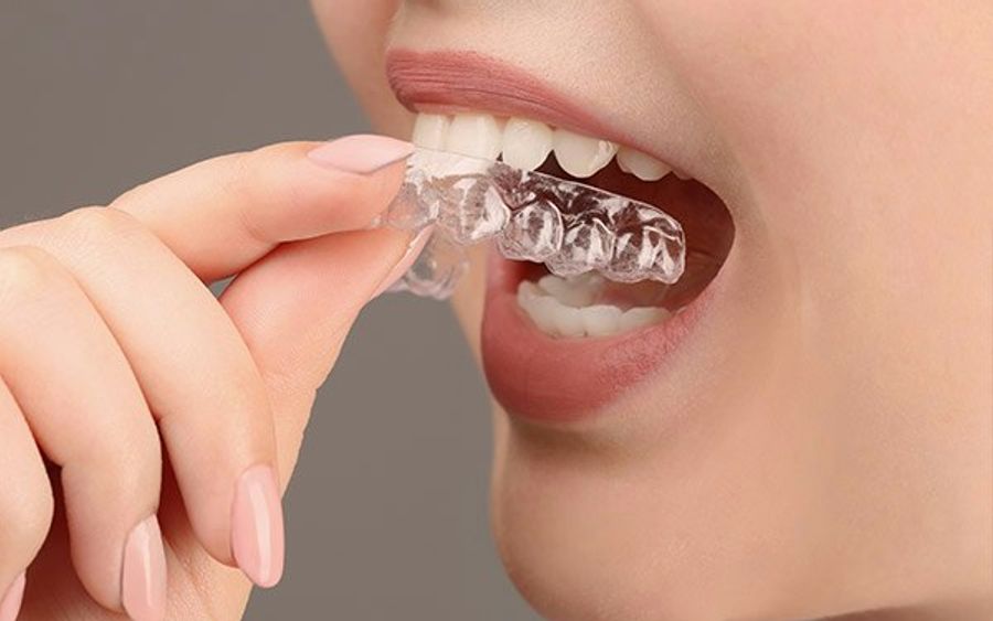 Woman putting on invisalign