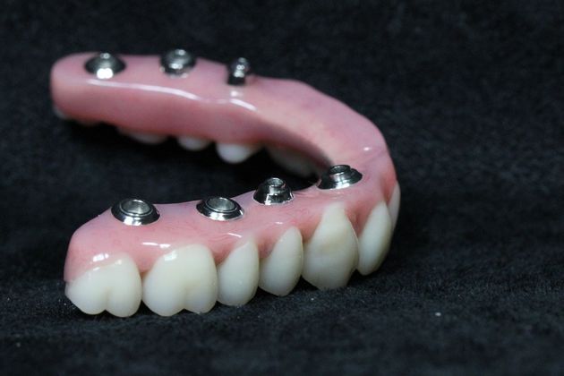 Teeth in a Day: Case 20 — Final Upper Restoration / Final Restoration before