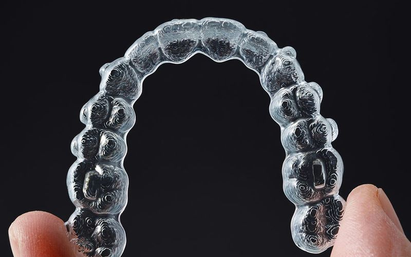 Clear aligner