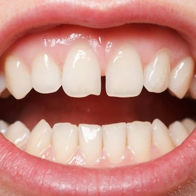 Person with a gap between teeth