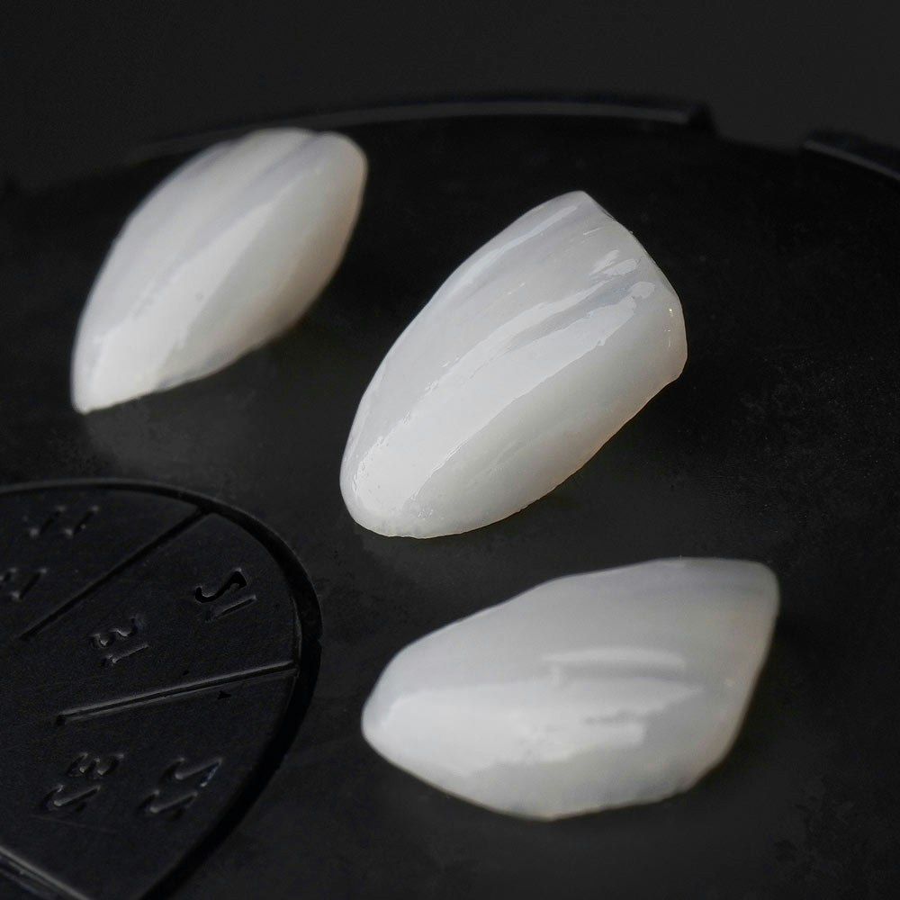 Porcelain veneers