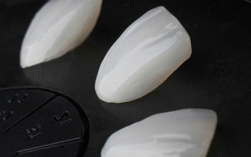 Porcelain veneers