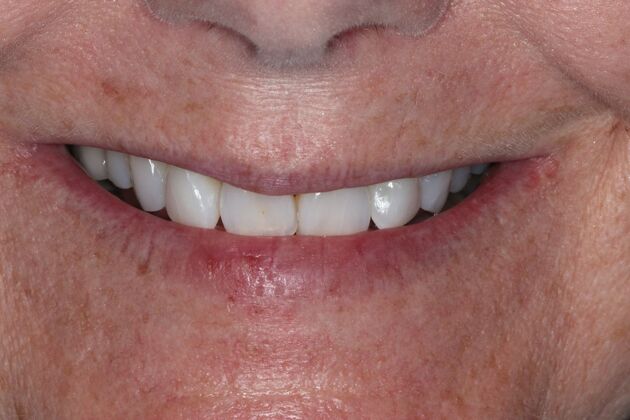 Teeth in a Day: Case 27 — before