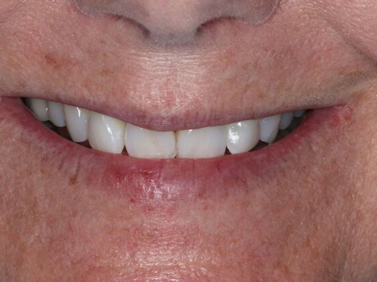 Teeth in a Day: Case 27 — before
