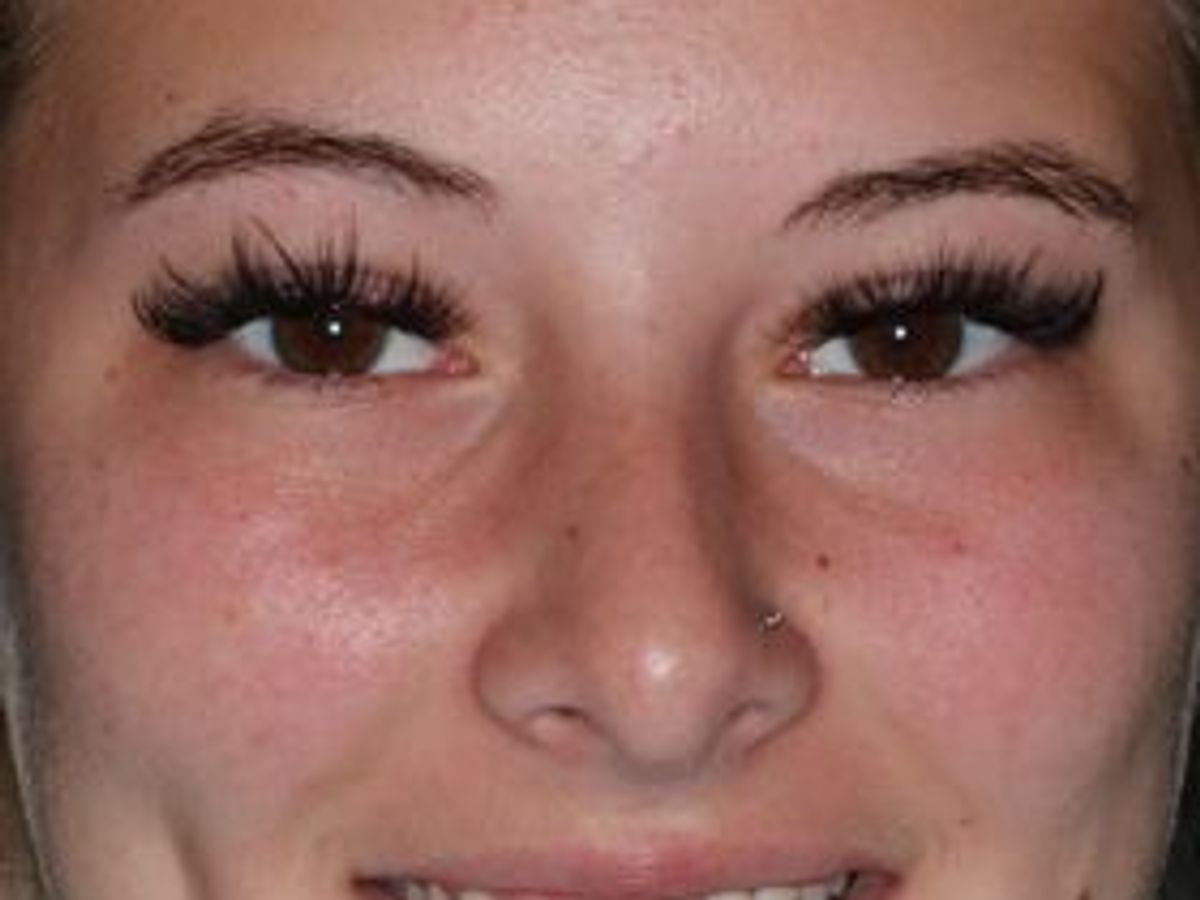 Veneers: Case 19 — before
