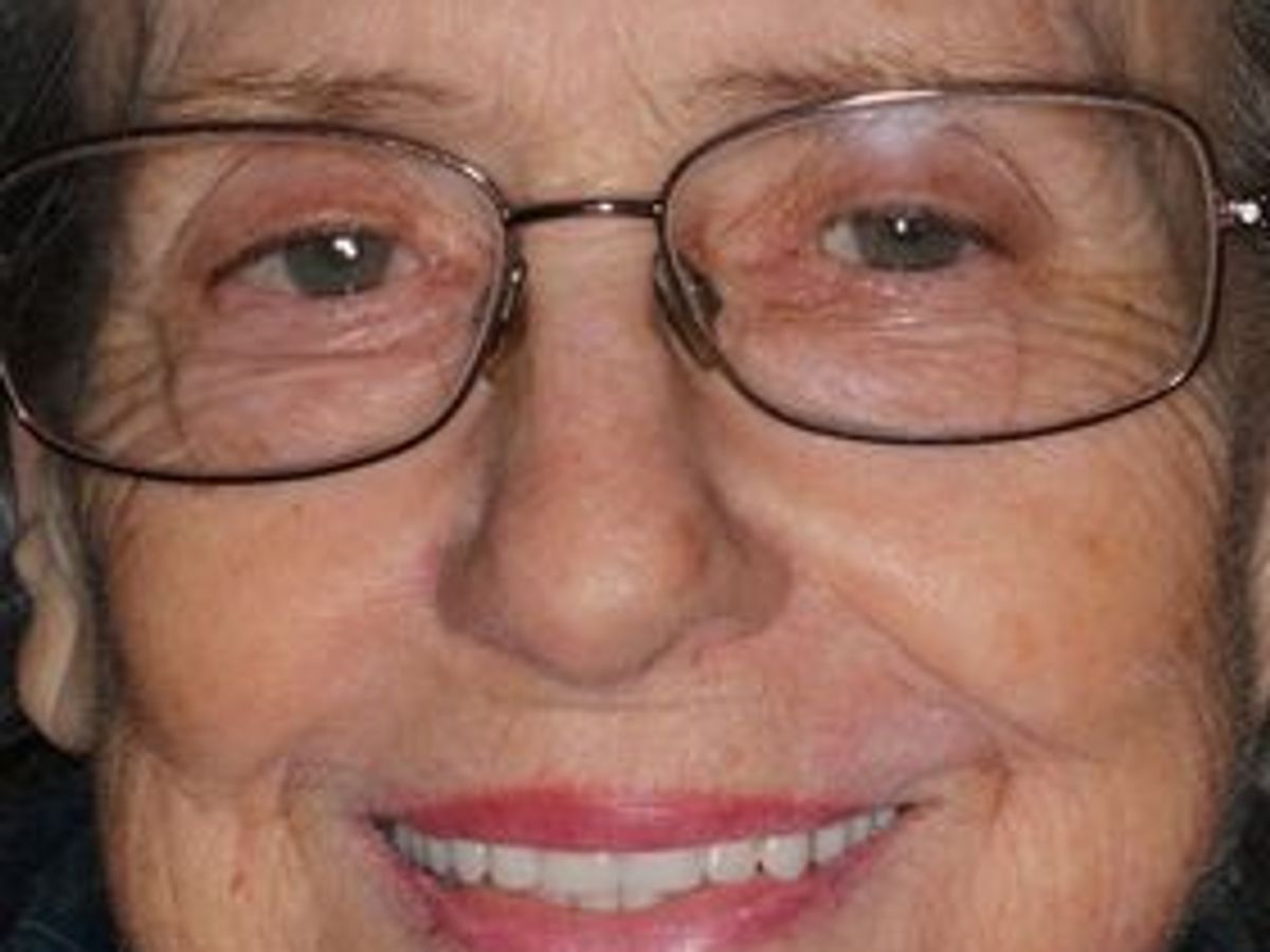 Dentures: Case 9 — after