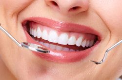 Benefits of Tooth-colored Fillings