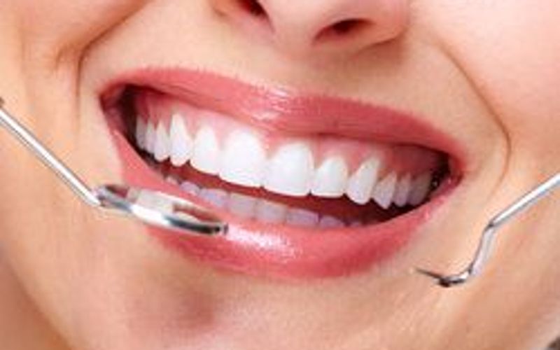 Benefits of Tooth-colored Fillings