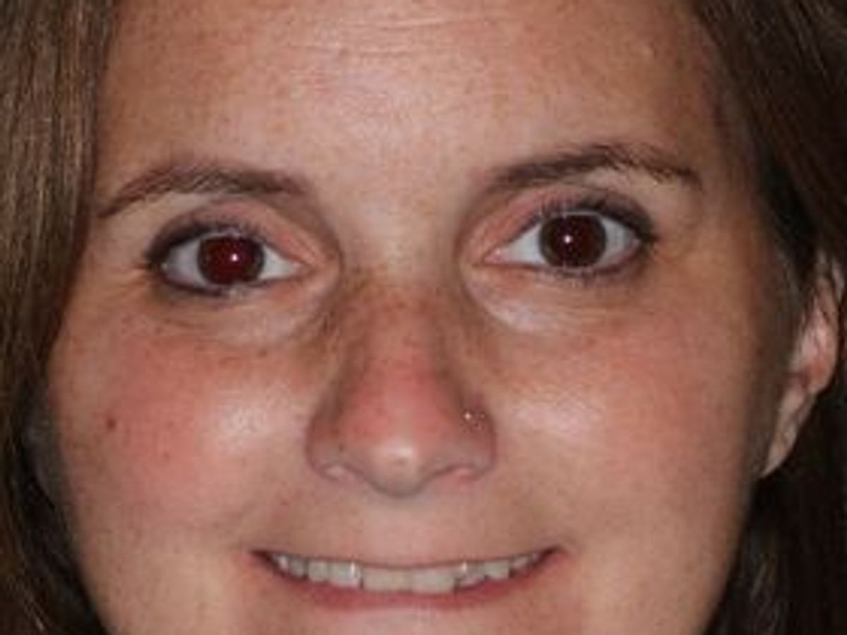 Veneers: Case 27 — before