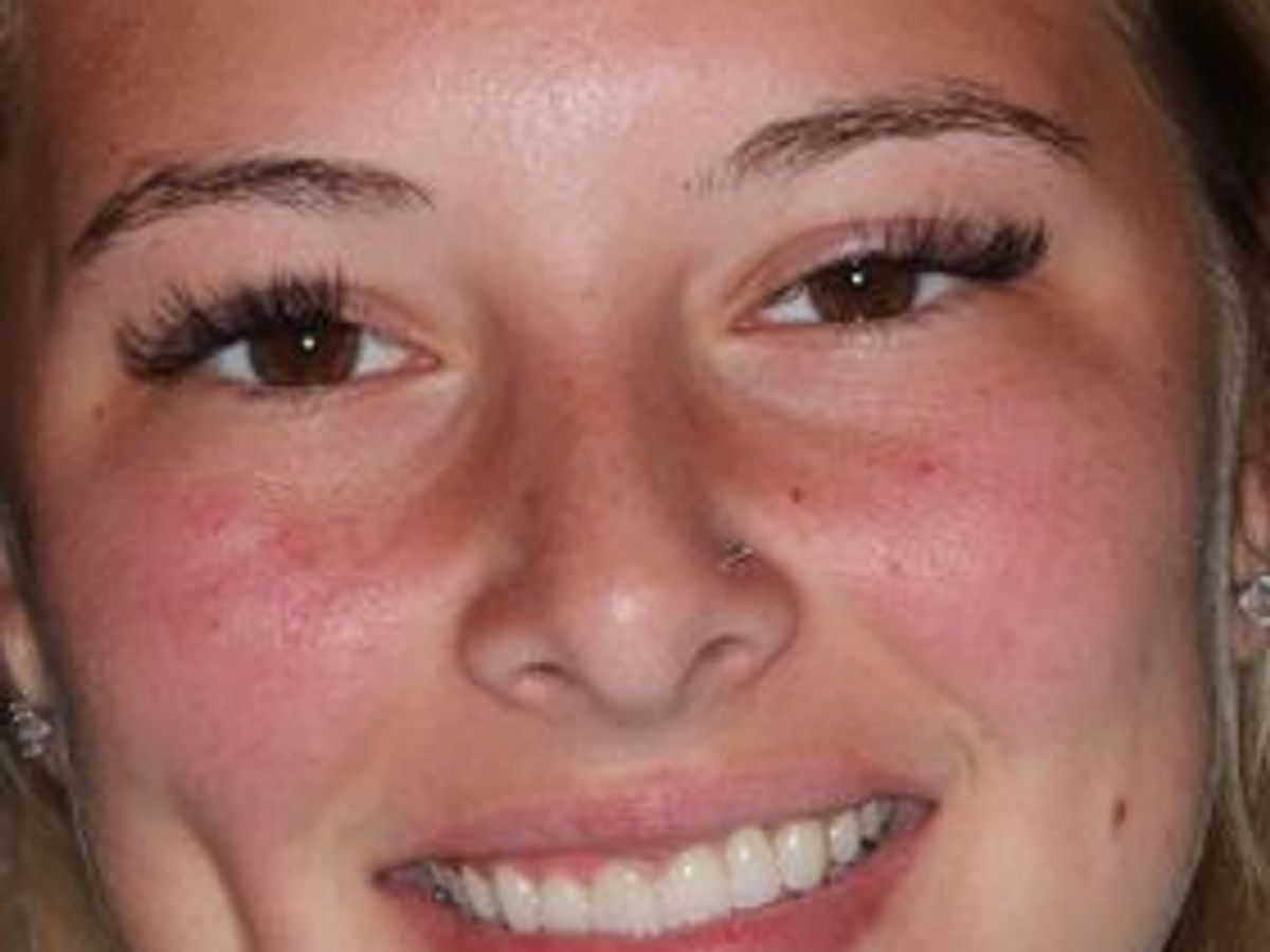 Veneers: Case 19 — after