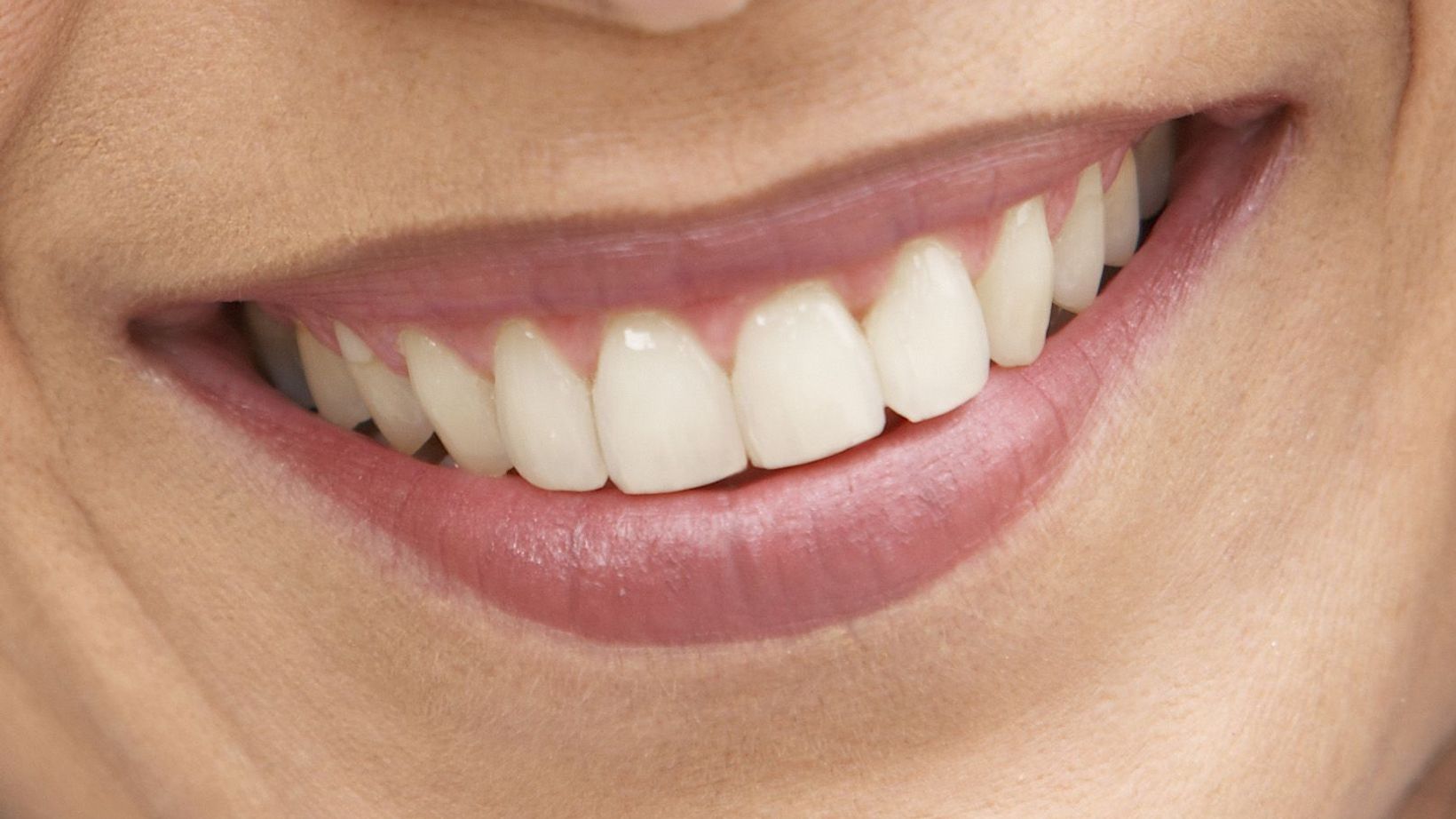 The Origin of Space: Common Causes of Tooth Loss