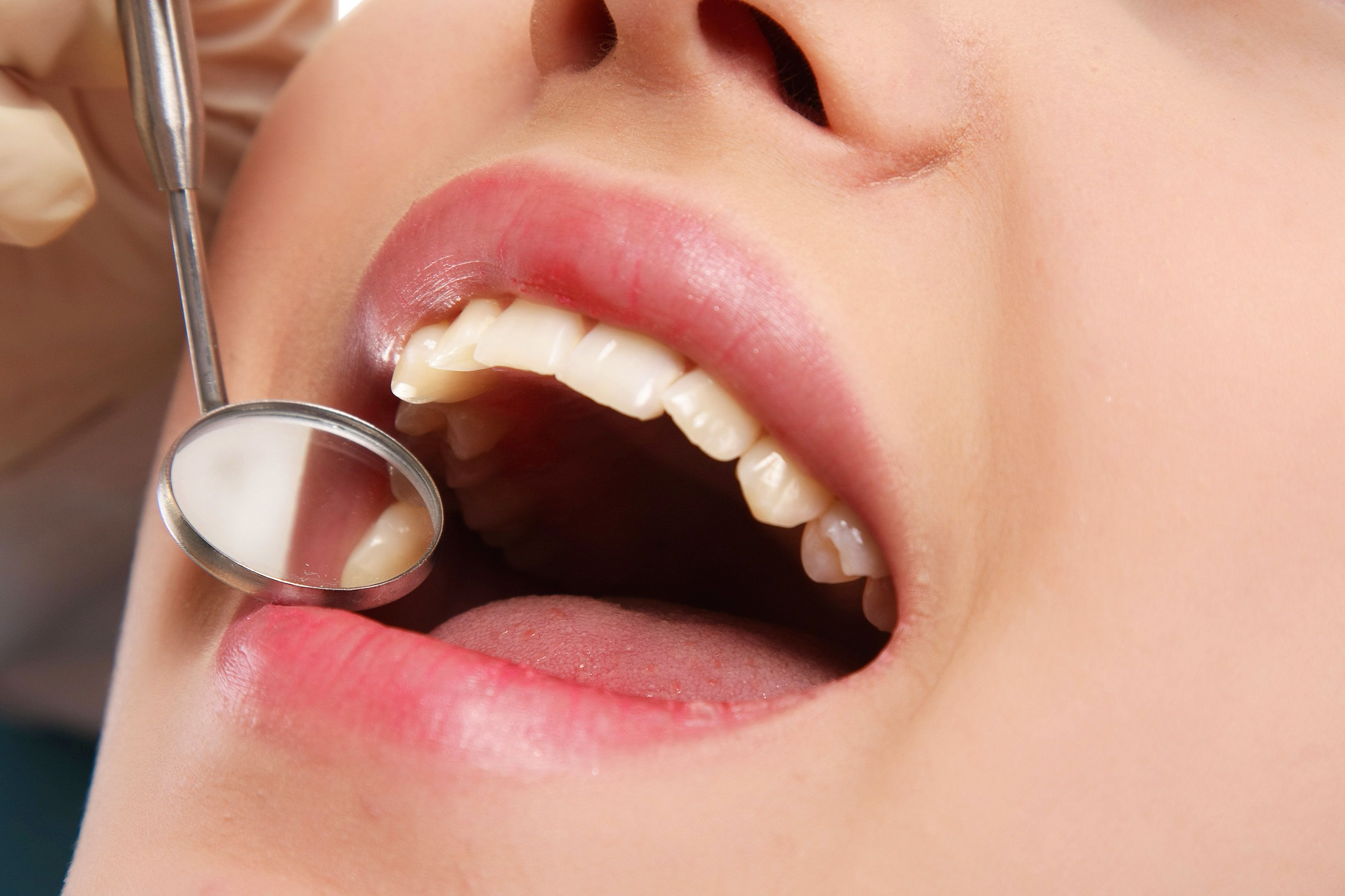 High and Dry: Why Dry Mouth Can Lead to Dental Problems