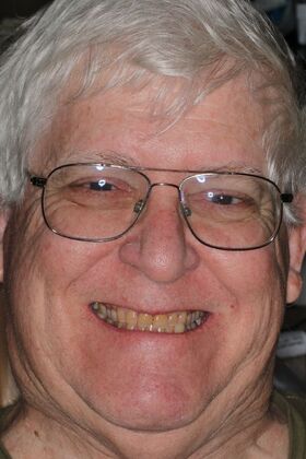 Veneers: Case 33 — before