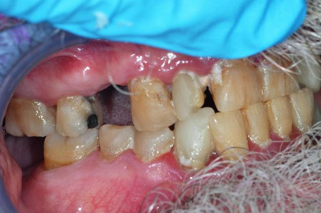 Teeth in a Day: Case 6 — before